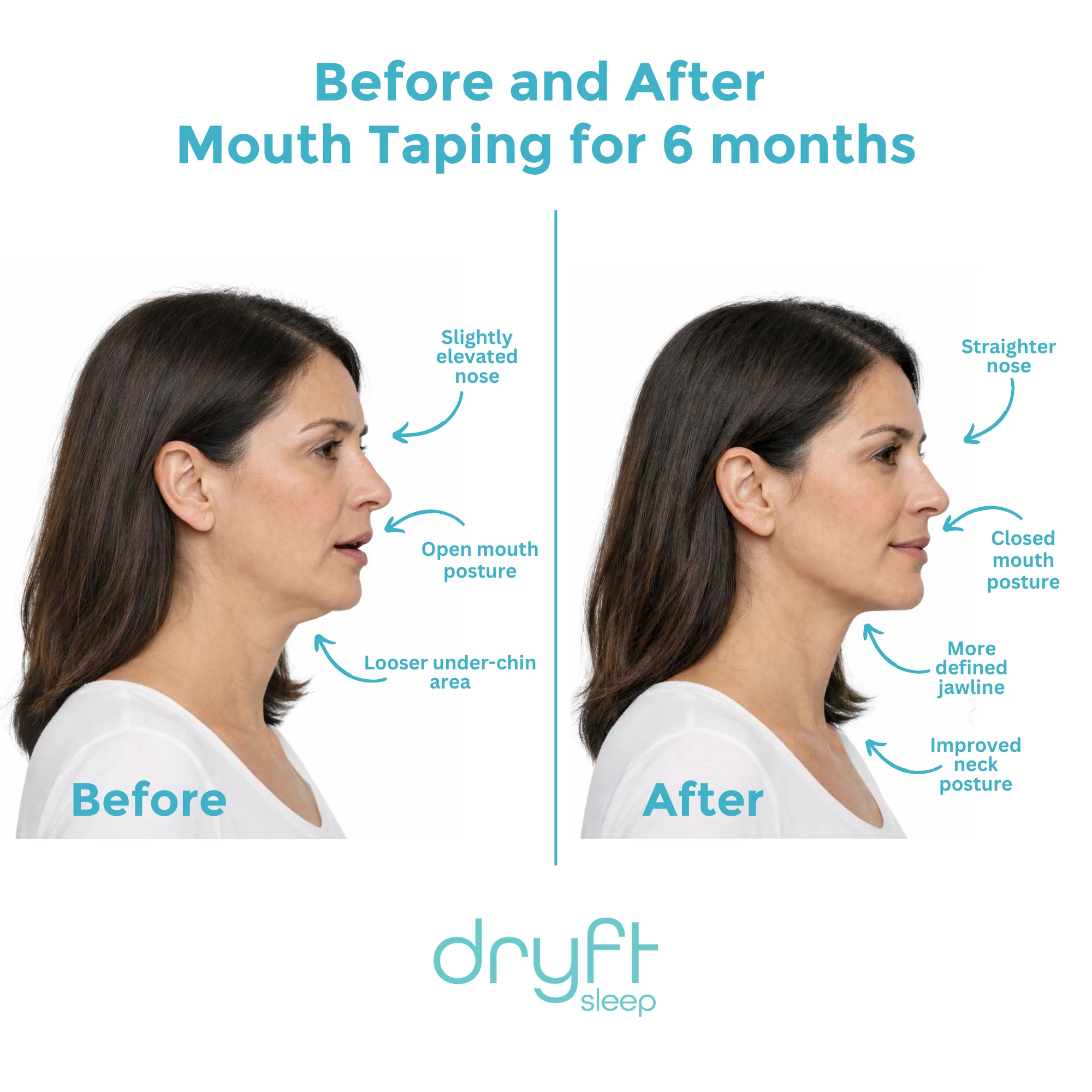 Dryft Sleep Mouth Tape - Image 2