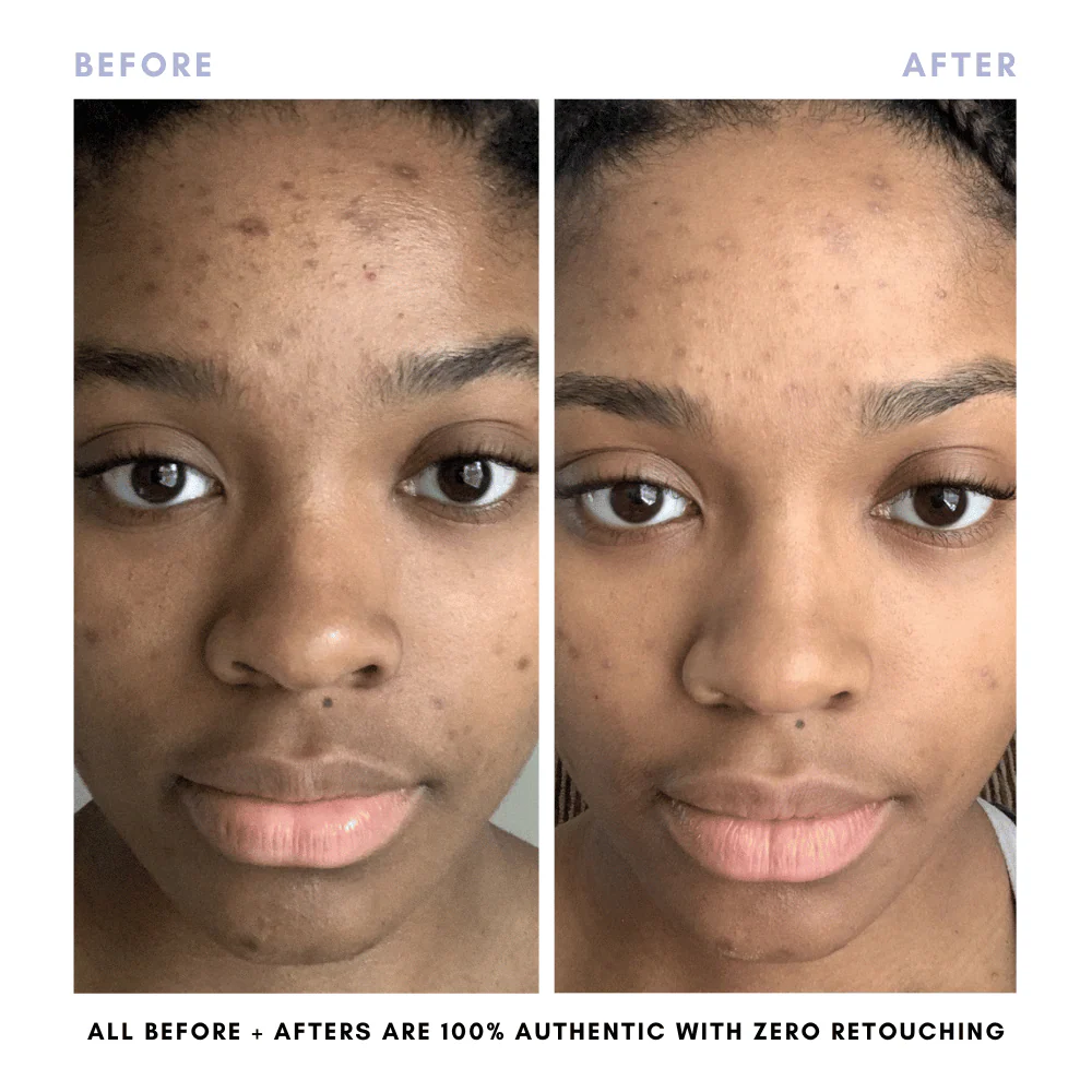 The Balanced Skin Set (Travel-Size) - Image 8
