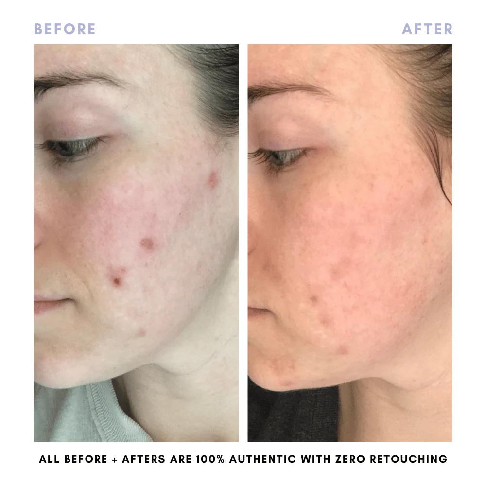The Complete Skincare Collection - Image 14