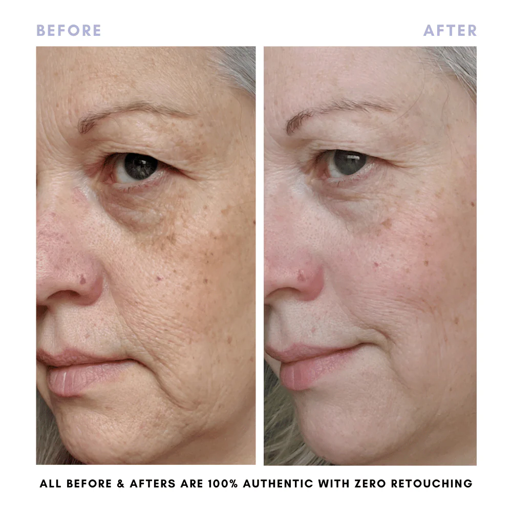 The Complete Skincare Collection - Image 15
