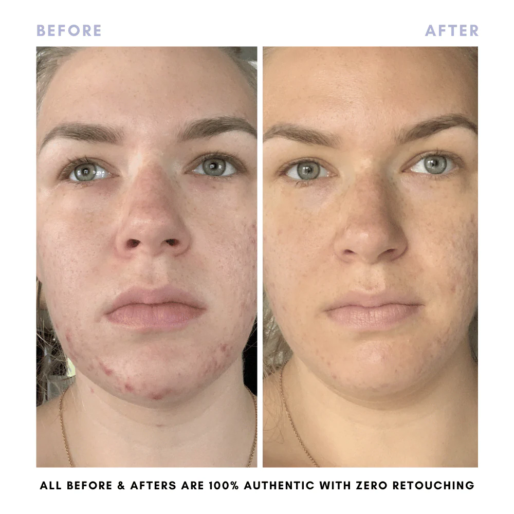 The Complete Skincare Collection - Image 16