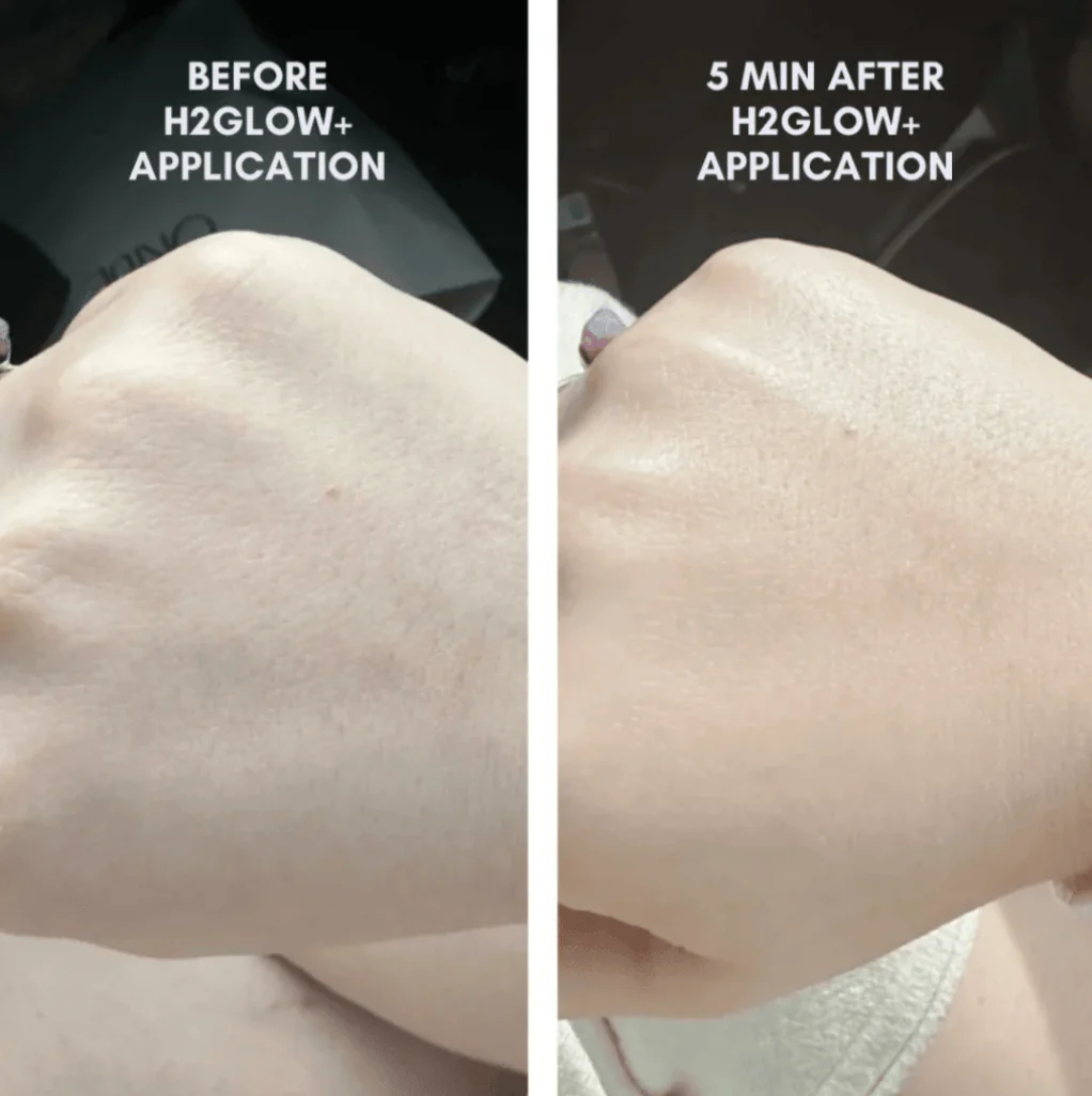 The Complete Skincare Collection - Image 3