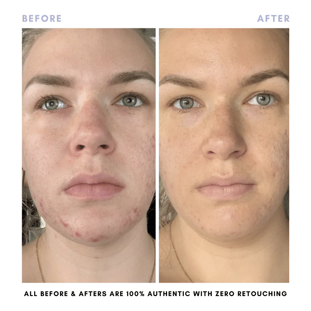 The Juicy Skin Special (+ FREE Rose Suds Cleanser) - Image 10