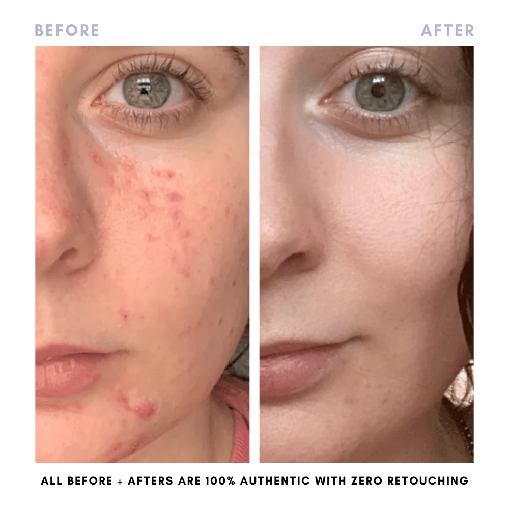 The Juicy Skin Special (+ FREE Rose Suds Cleanser) - Image 6